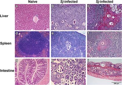 Galectins, Eosinophiles, and Macrophages May Contribute to Schistosoma japonicum Egg-Induced Immunopathology in a Mouse Model